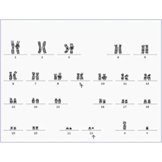 bone marrow chromosome analysis